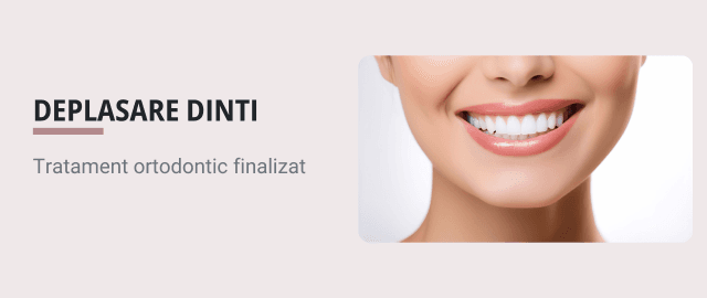 De ce se strâmbă dinții după aparat dentar? Rolul retainerului